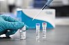 Erba MDx SARS-COV-2 RT-PCR Kit