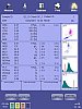Hematology analyzer ELite 5